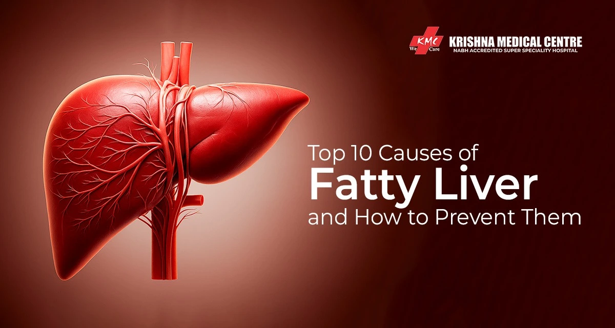 Top 10 Causes of Fatty Liver and How to Prevent Them