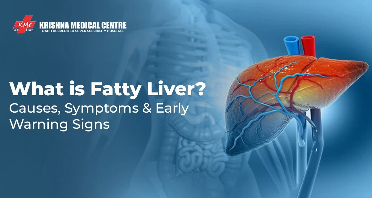 What Is Fatty Liver? Causes, Symptoms & Early Warning Signs